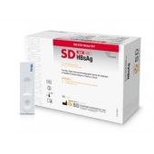 Hepatitis B Virus Test