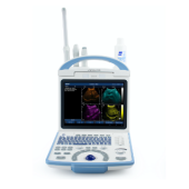 Portable Digital Diagnostic Ultrasound System CU30