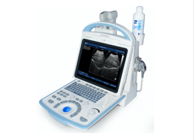 Portable Digital Diagnostic Ultrasound System CU30 - Image 3