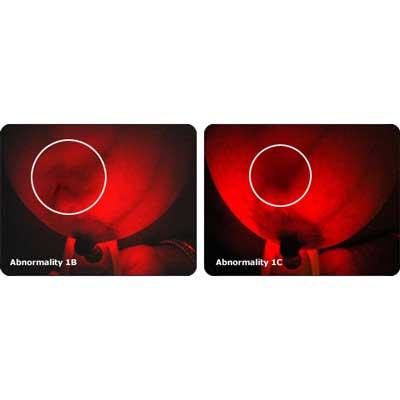 Breastlight™-Earlier Breast Screening Device - Image 4