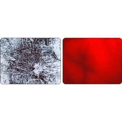 Breastlight™-Earlier Breast Screening Device - Image 5