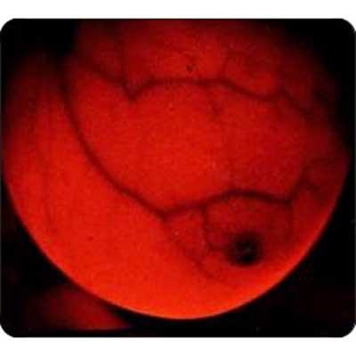 Breastlight™-Earlier Breast Screening Device - Image 6