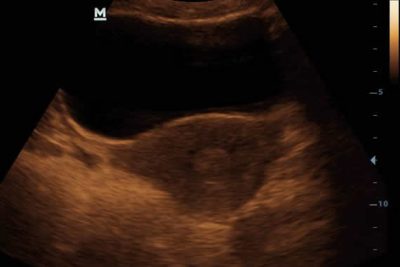 DP-10 Digital Ultra Diagnostic Imaging System Ultrasound Machine - Image 5