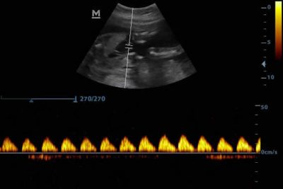 DP-10 Digital Ultra Diagnostic Imaging System Ultrasound Machine - Image 6