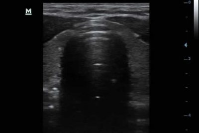 DP-10 Digital Ultra Diagnostic Imaging System Ultrasound Machine - Image 7