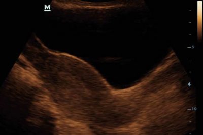 DP-20 Digital Ultra Diagnostic Imaging System - Image 6