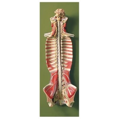 Spinal Cord in the spinal Canal soft
