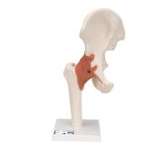 Life Size Anatomical Functional Human Hip Joint Anatomy Model