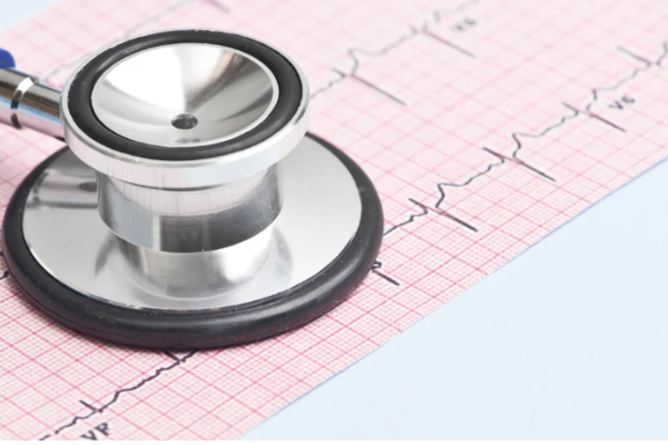The Importance of ECG Machines in Cardiac Diagnosis