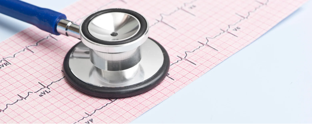 A modern ECG machine with electrode leads connected to a patient undergoing cardiac monitoring in a hospital setting.