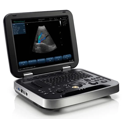 PU-L151B Portable Color Doppler Ultrasound System - High-Performance Diagnostic Imaging