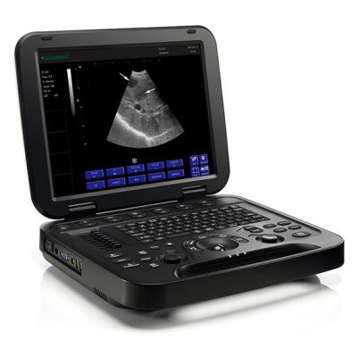 A Periodmed PU-DL151A Portable Ultrasound Machine featuring a compact design with a high-resolution display, ideal for medical imaging in various settings