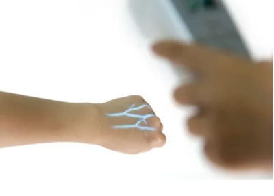 Vein Detector Price in Pakistan Affordable BM 100 vein viewer - Image 2